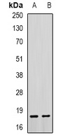 Troponin C Rabbit Polyclonal Antibody
