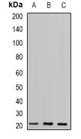 Glyoxalase I Rabbit Polyclonal Antibody