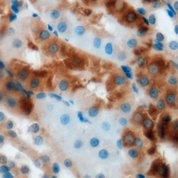 GLO1 antibody