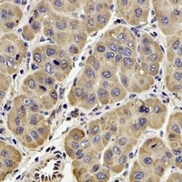 Anti-GPx-4 Antibody