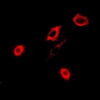 Anti-GPx-4 Antibody