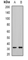 RCAS1 Rabbit Polyclonal Antibody