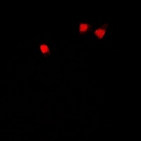 Anti-U2AF65 Antibody