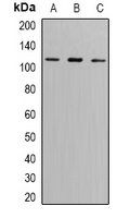 GLUR6 Antibody