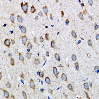 Anti-PSMD10 Antibody