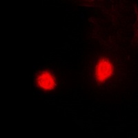Anti-PSMD10 Antibody