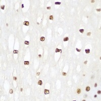 Histone H2B Rabbit Polyclonal Antibody