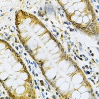 Anti-PGK1 Antibody