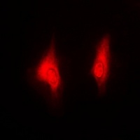 Anti-PSMB5 Antibody