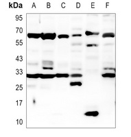 TMPRSS2 Antibody