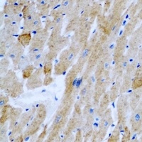 Anti-OGT Antibody
