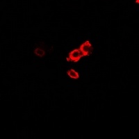 Anti-OGT Antibody