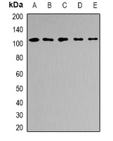 AP2-beta-1 Rabbit Polyclonal Antibody