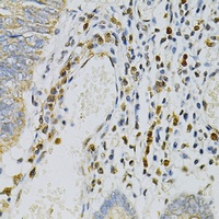 Anti-CDA Antibody