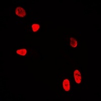 Anti-WDR5 Antibody