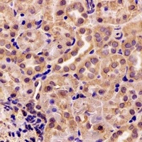 AK4 antibody