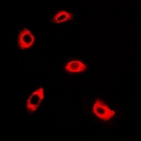 Anti-AK4 Antibody