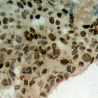 Anti-TorsinA Antibody