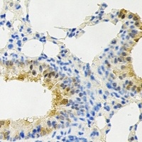 Anti-PPX Antibody