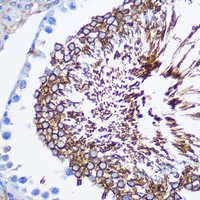 Anti-SPAM1 Antibody