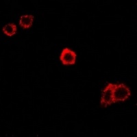 Anti-SPAM1 Antibody