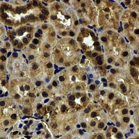 Anti-HCCR-1 Antibody