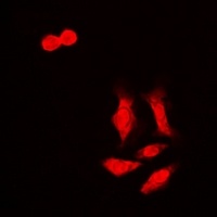 Anti-HCCR-1 Antibody