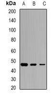 SCCPDH Antibody