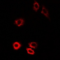 Anti-HIWI1 Antibody