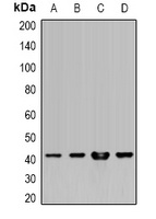 HLA-A Rabbit Polyclonal Antibody