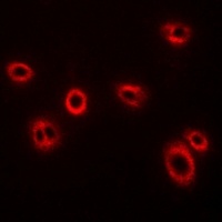 Anti-HLA-A Antibody