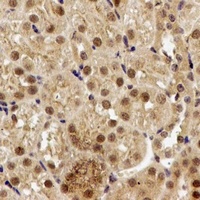 Anti-PPP2R2A Antibody