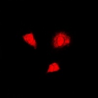 Anti-PSMA6 Antibody