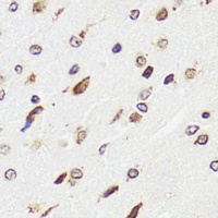 Anti-EDF1 Antibody