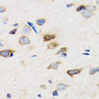Anti-SIAH1 Antibody