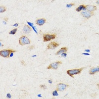 SIAH1 antibody