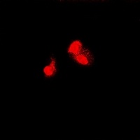 SIAH1 antibody