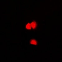 Anti-CASK Antibody