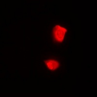 Anti-PSMA2 Antibody