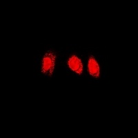 Anti-PSMC4 Antibody