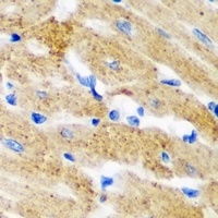 Anti-HNMT Antibody
