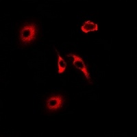 Anti-HNMT Antibody