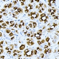 Anti-PRG2 Antibody