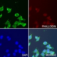 Anti-PRG2 Antibody