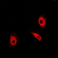 TIM Antibody