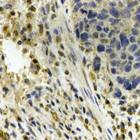 Anti-ALDH4A1 Antibody