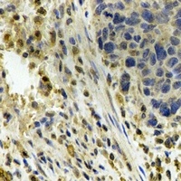 ALDH4A1 antibody