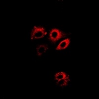 ALDH4A1 antibody