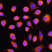 Anti-GNAS Antibody