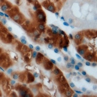 Anti-CPT2 Antibody